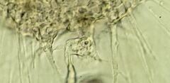 Actinosphaerium eichhornii