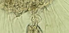 Actinosphaerium eichhornii