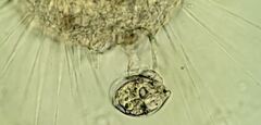 Actinosphaerium eichhornii