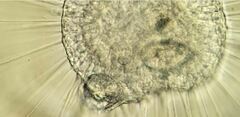 Actinosphaerium eichhornii