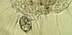 Actinosphaerium eichhornii