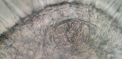 Actinosphaerium eichhornii
