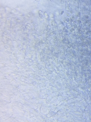 Cuphophyllus angustifolius