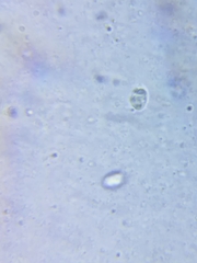 Cuphophyllus angustifolius