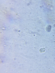 Cuphophyllus angustifolius