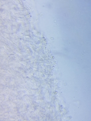 Cuphophyllus angustifolius