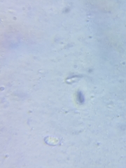 Cuphophyllus angustifolius