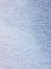 Cuphophyllus angustifolius