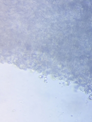 Cuphophyllus angustifolius