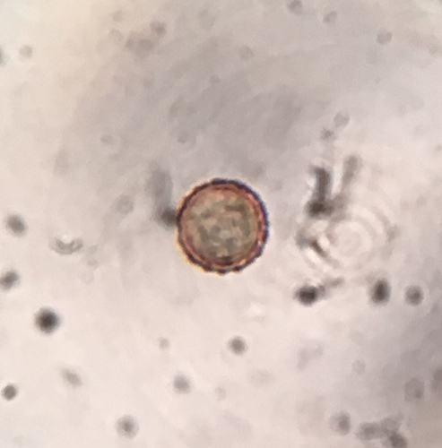 Astraeus morganii image