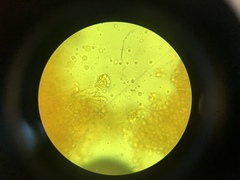 Heliomyces decolorans