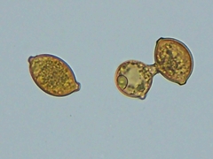 Botryobasidium simile