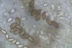 Ascobolus furfuraceus