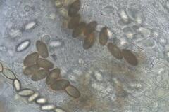 Ascobolus furfuraceus