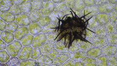 Epibryon plagiochilae