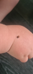 Coccinella undecimpunctata
