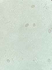 Volvariella murinella