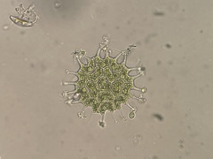 Pseudopediastrum boryanum longicorne