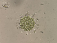 Pseudopediastrum boryanum longicorne