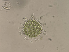 Pseudopediastrum boryanum longicorne