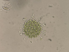 Pseudopediastrum boryanum longicorne