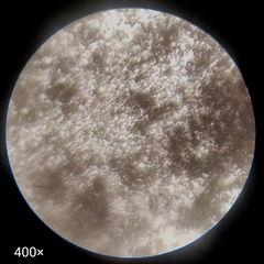 Ascomycota
