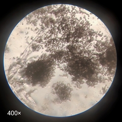 Ascomycota