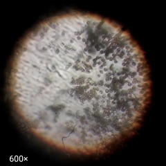 Ascomycota