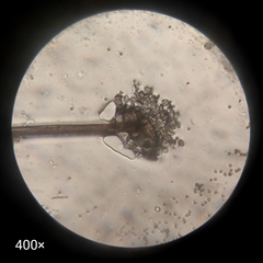 Ascomycota