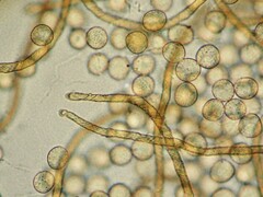 Hemitrichia lutescens