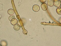 Hemitrichia lutescens
