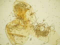Hemitrichia lutescens