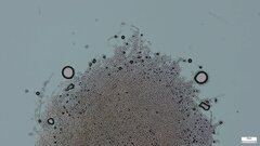 Botryobasidium