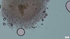 Botryobasidium