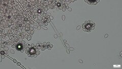 Botryobasidium