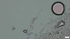 Botryobasidium