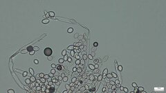 Botryobasidium