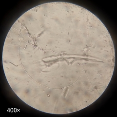 Fungi