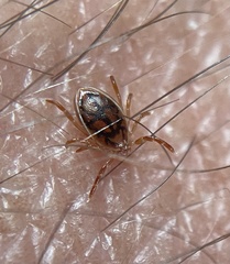 Ixodes cornuatus
