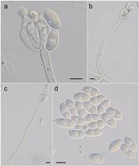 Achroiostachys aurantispora