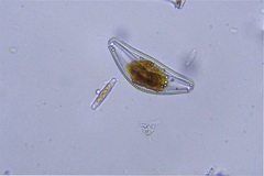 Cymbella