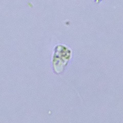 Protozoa