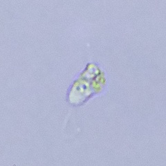Protozoa