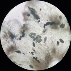 Rhizocarpon oportense