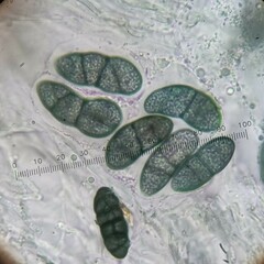 Rhizocarpon oportense