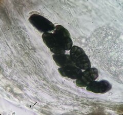 Rhizocarpon oportense