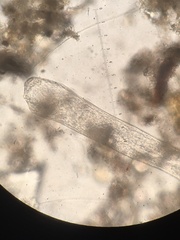 Spirostomum