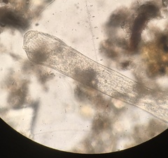 Spirostomum