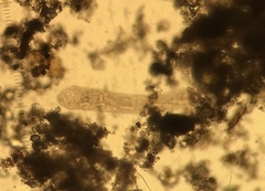 Spirostomum