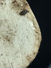 Scleroderma